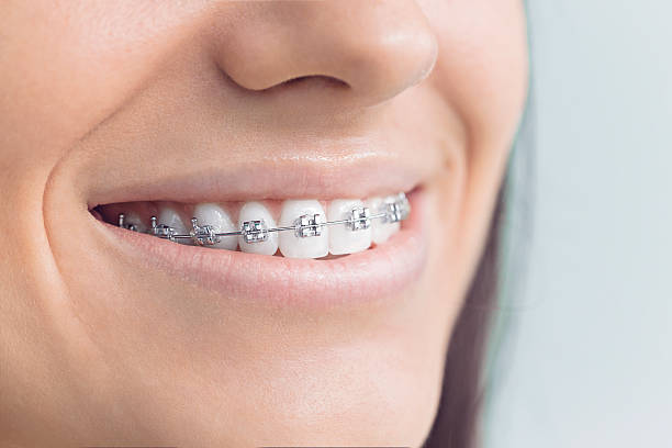 Best Full Mouth Reconstruction  in Tiger Point, FL